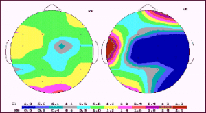 méditation sans musique